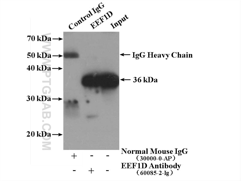 Immunoprecipitation (IP) experiment of MCF-7 cells using EEF1D Monoclonal antibody (60085-2-Ig)