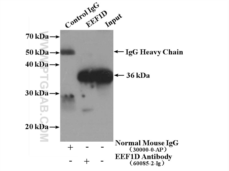 Immunoprecipitation (IP) experiment of MCF-7 cells using EEF1D Monoclonal antibody (60085-2-Ig)
