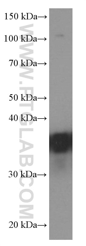 Western Blot (WB) analysis of Jurkat cells using EEF1D Monoclonal antibody (60085-2-Ig)