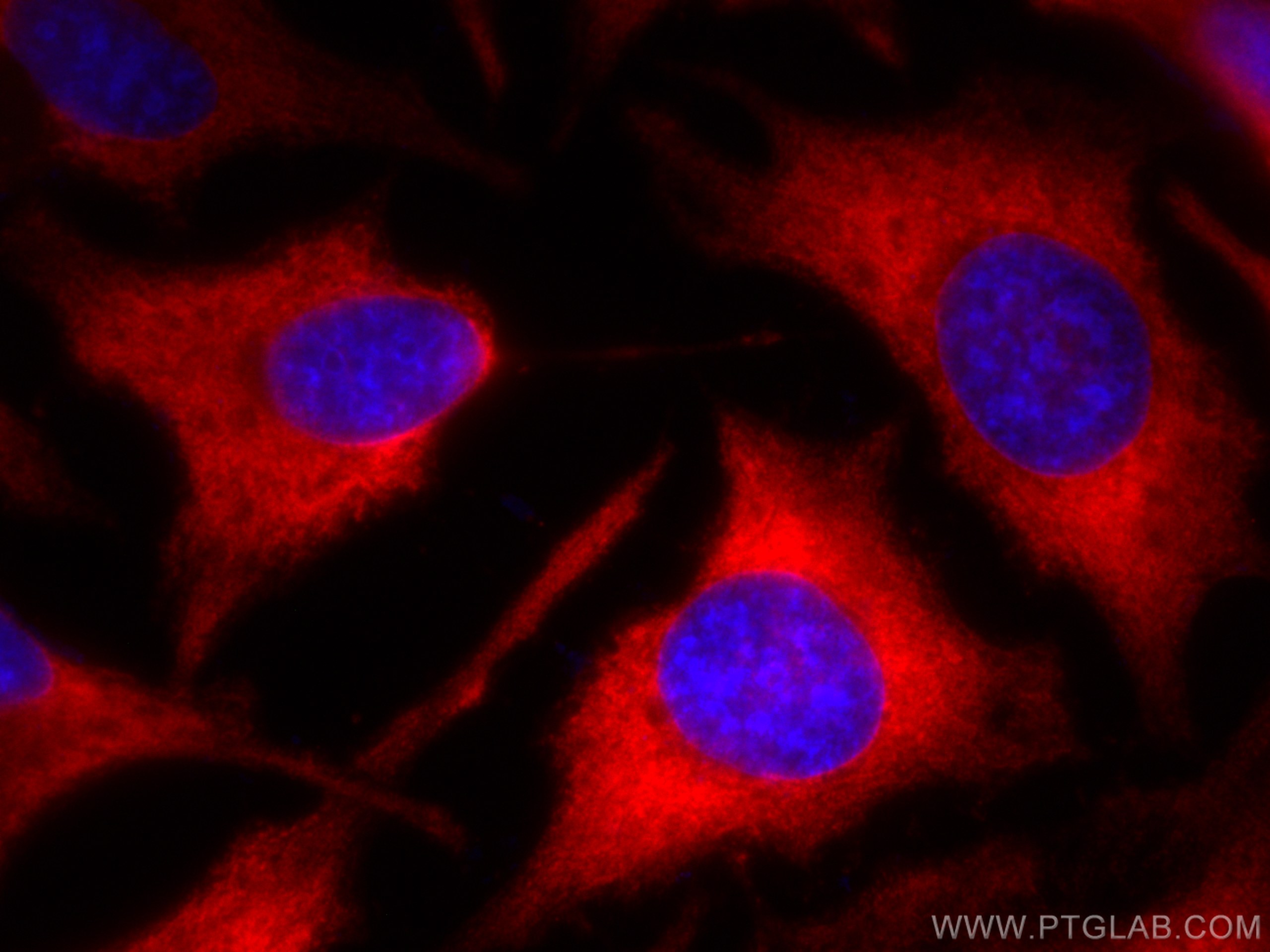 Immunofluorescence (IF) / fluorescent staining of HeLa cells using CoraLite®594-conjugated EEF1D Monoclonal antibody (CL594-60085)