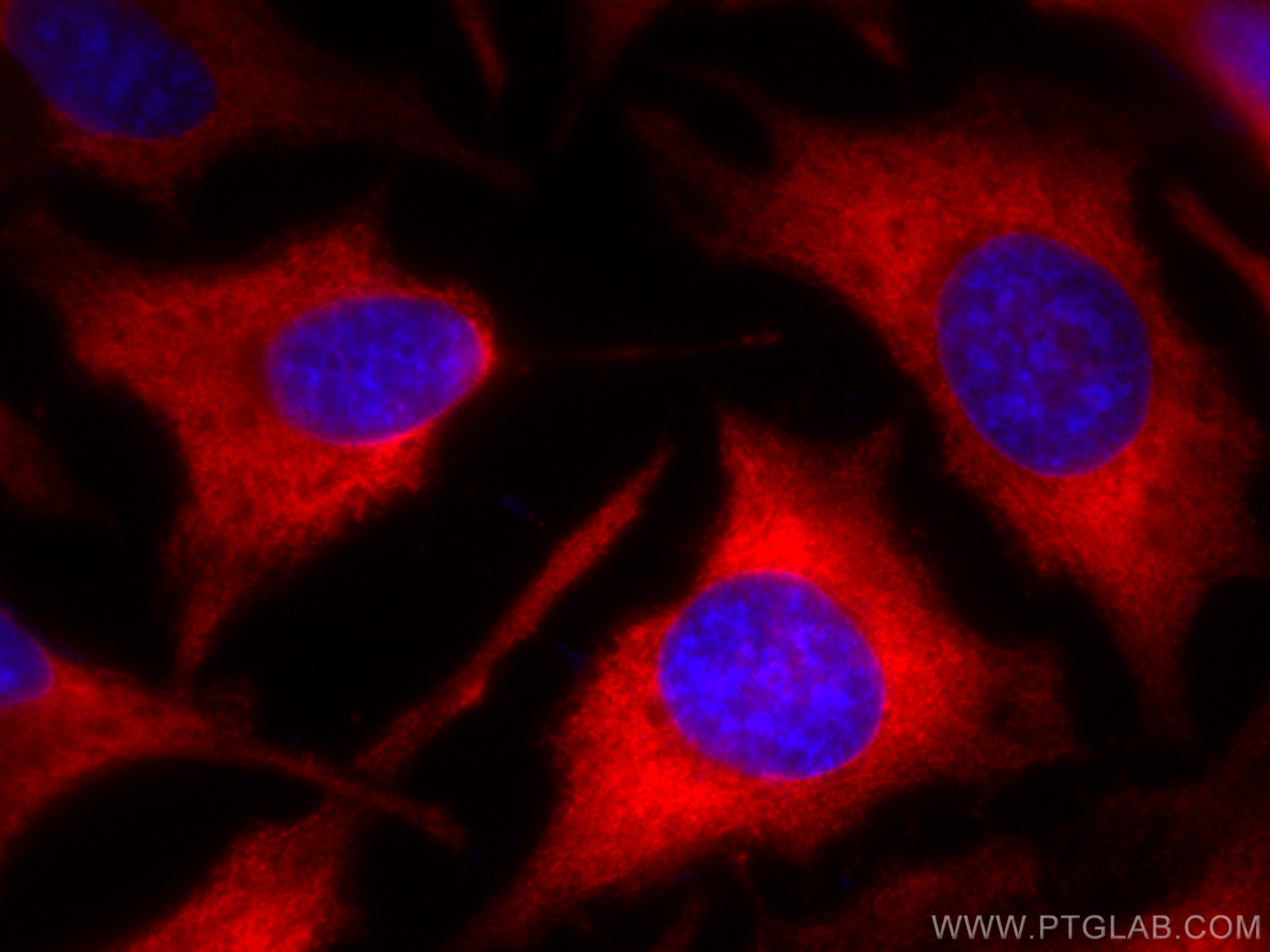 IF Staining of HeLa using CL594-60085