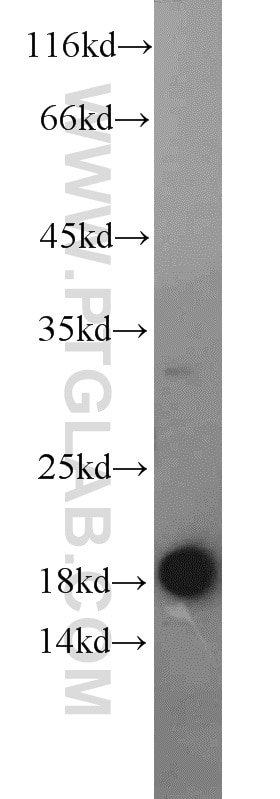 Western Blot (WB) analysis of human testis tissue using EEF1E1 Polyclonal antibody (10805-1-AP)