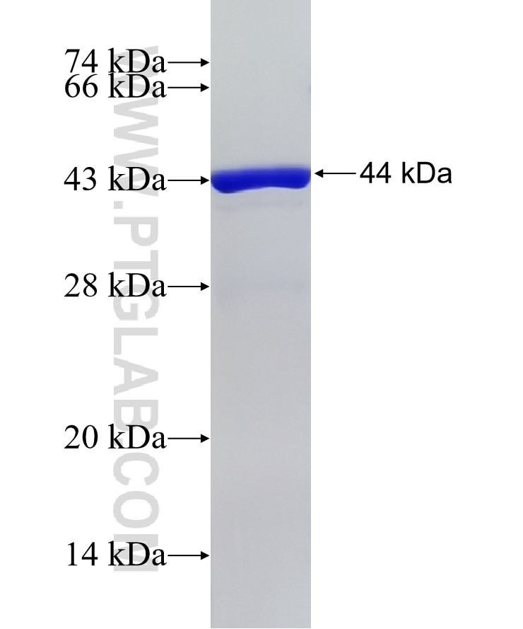 EEF1E1 fusion protein Ag1092 SDS-PAGE