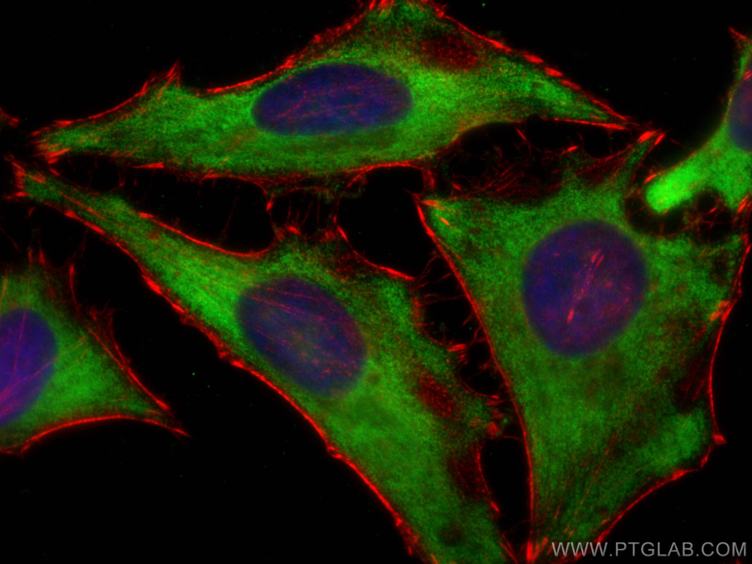 Immunofluorescence (IF) / fluorescent staining of HeLa cells using EEF1G Monoclonal antibody (68148-1-Ig)
