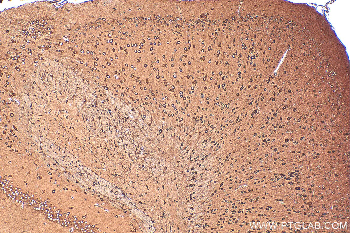 Immunohistochemistry (IHC) staining of mouse brain tissue using EEF2 Polyclonal antibody (20107-1-AP)