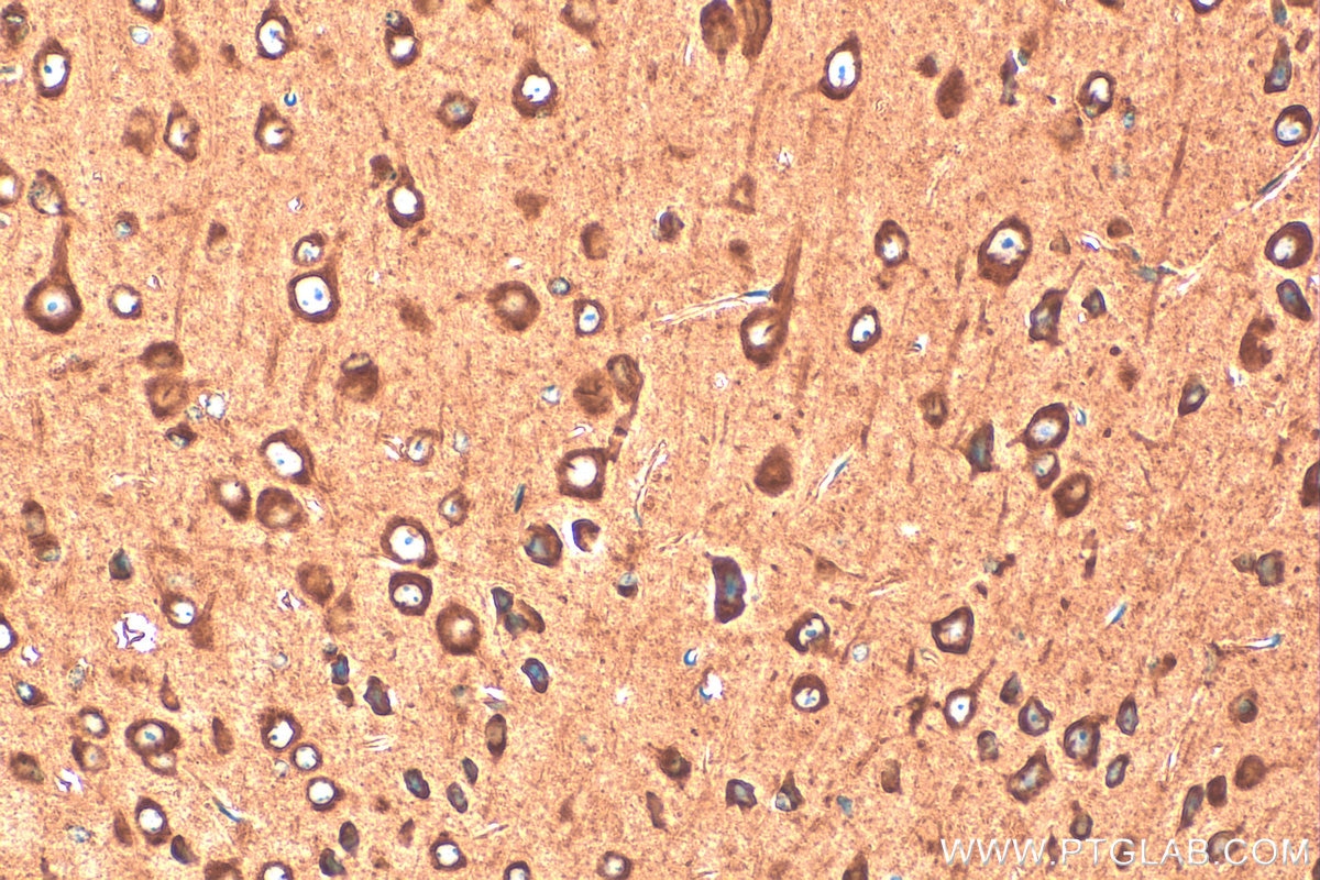 Immunohistochemistry (IHC) staining of mouse brain tissue using EEF2 Polyclonal antibody (20107-1-AP)