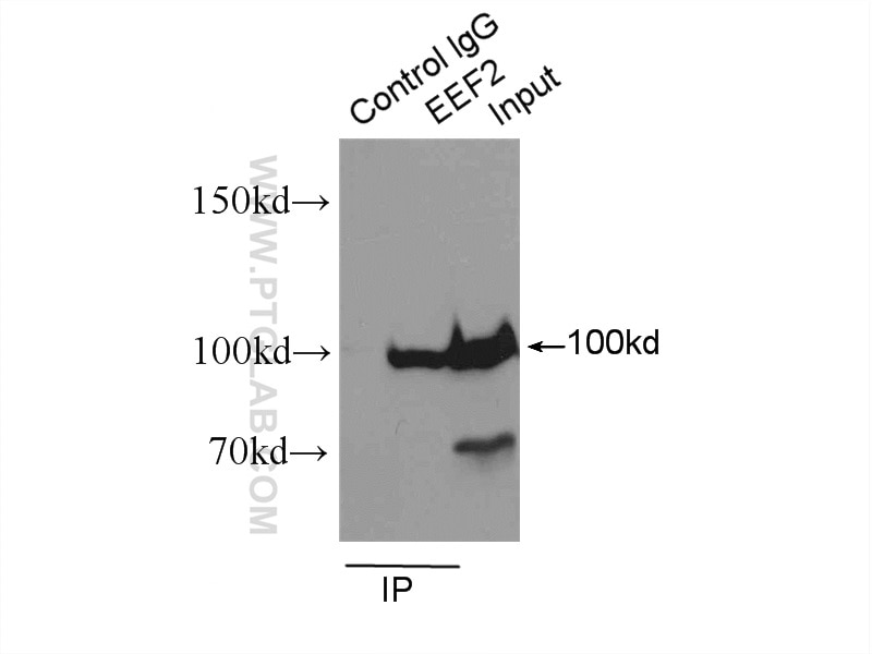 Immunoprecipitation (IP) experiment of HeLa cells using EEF2 Polyclonal antibody (20107-1-AP)