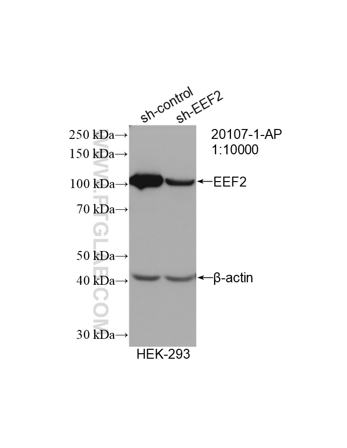 Western Blot (WB) analysis of HEK-293 cells using EEF2 Polyclonal antibody (20107-1-AP)
