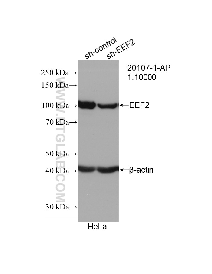 Western Blot (WB) analysis of HeLa cells using EEF2 Polyclonal antibody (20107-1-AP)