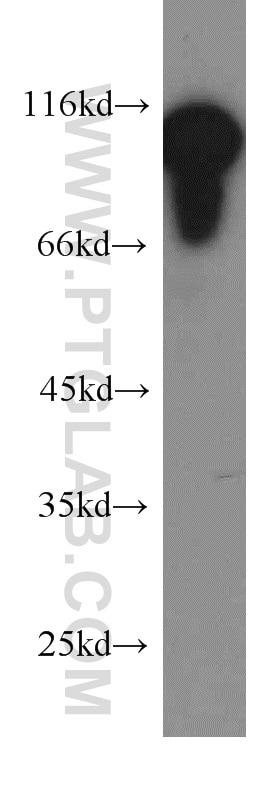 Western Blot (WB) analysis of NIH/3T3 cells using EEF2 Polyclonal antibody (20107-1-AP)