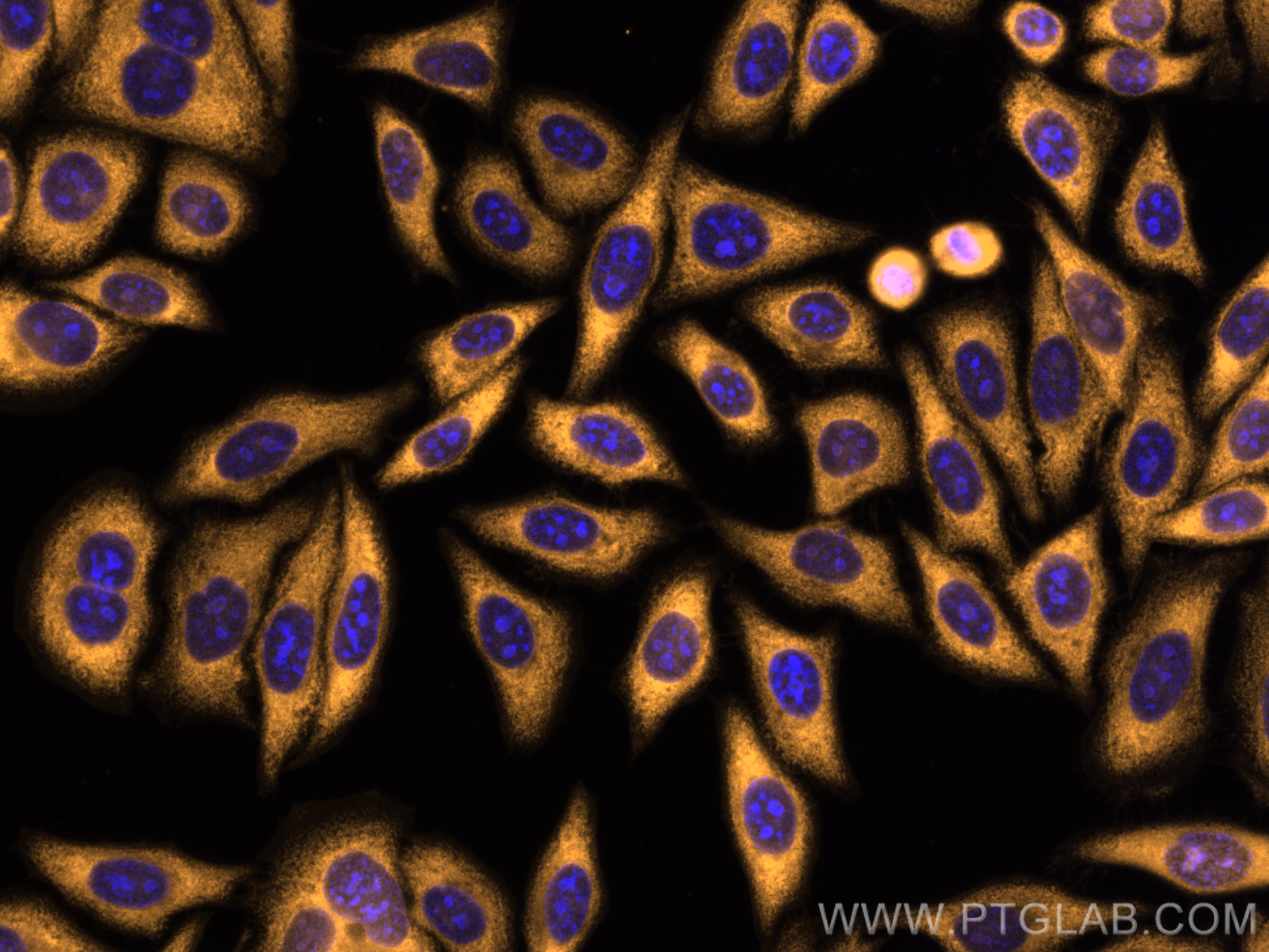 IF Staining of HepG2 using CL555-67550