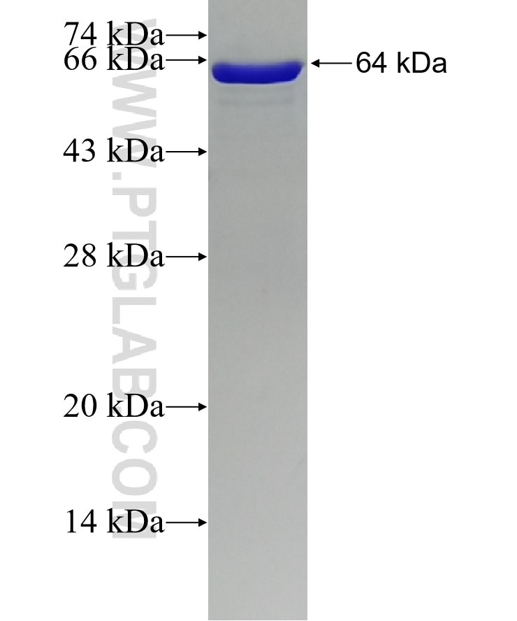 EEF2 fusion protein Ag13826 SDS-PAGE