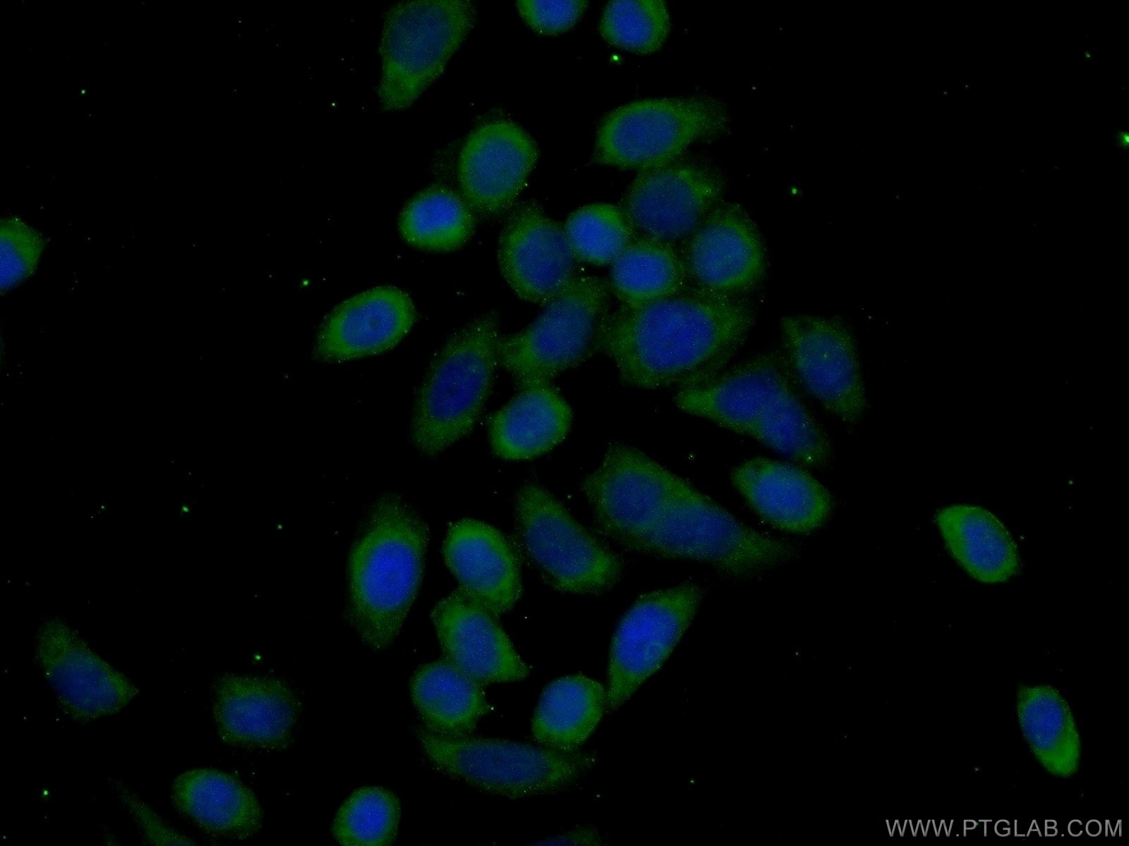 Immunofluorescence (IF) / fluorescent staining of PC-3 cells using eEF2K Polyclonal antibody (13510-1-AP)
