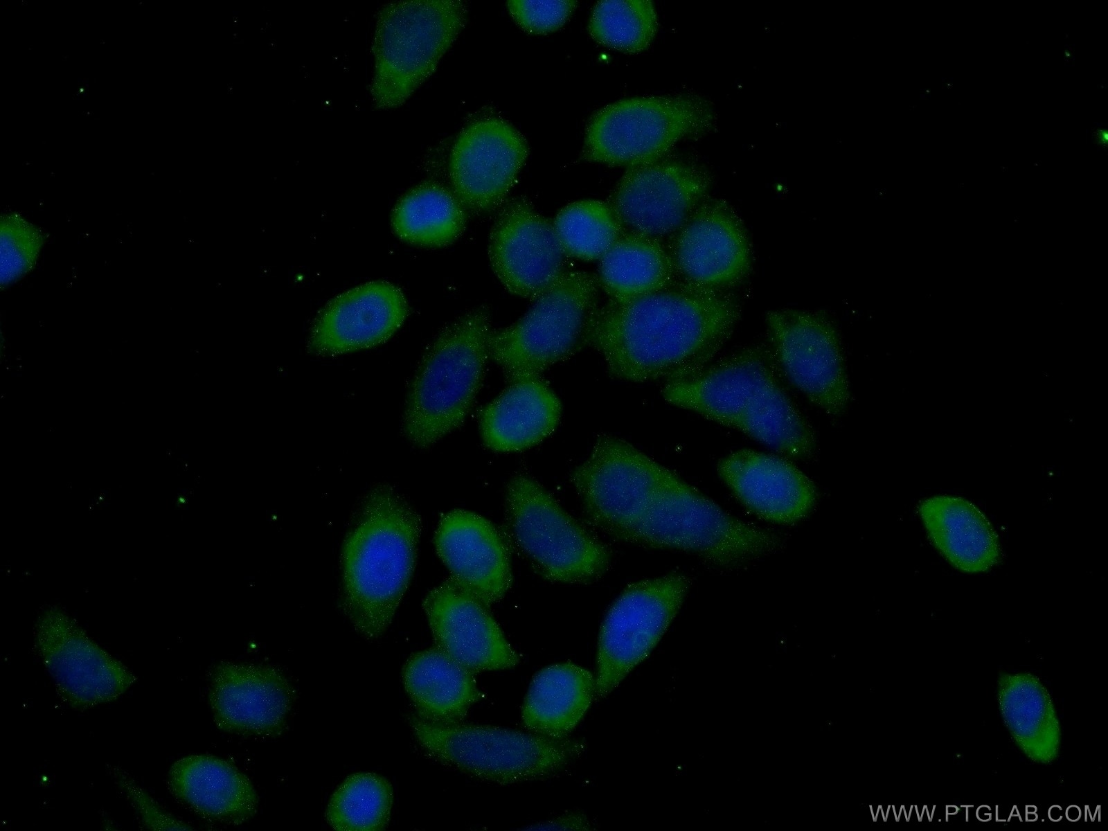 IF Staining of PC-3 using 13510-1-AP