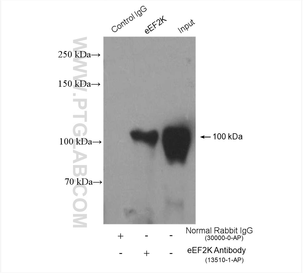 Immunoprecipitation (IP) experiment of PC-3 cells using eEF2K Polyclonal antibody (13510-1-AP)