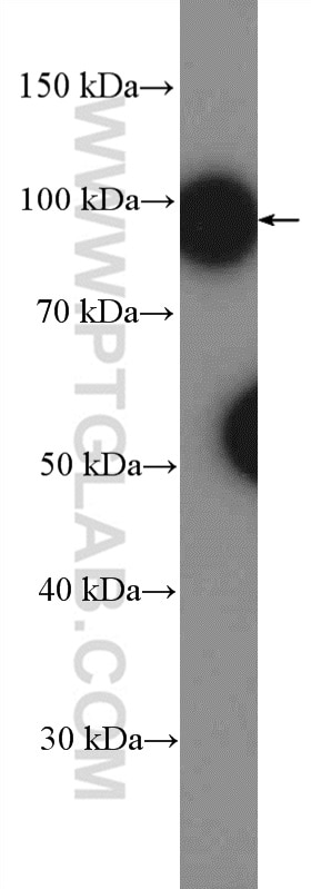 Western Blot (WB) analysis of Jurkat cells using eEF2K Polyclonal antibody (13510-1-AP)