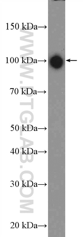 Western Blot (WB) analysis of HEK-293 cells using eEF2K Polyclonal antibody (13510-1-AP)