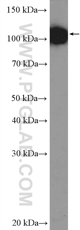 Western Blot (WB) analysis of PC-3 cells using eEF2K Polyclonal antibody (13510-1-AP)