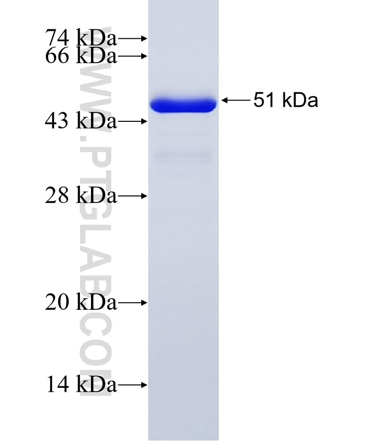 EEF2K fusion protein Ag25158 SDS-PAGE
