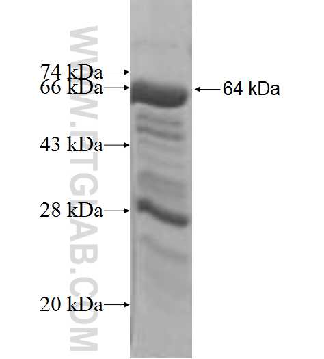EEF2K fusion protein Ag4432 SDS-PAGE