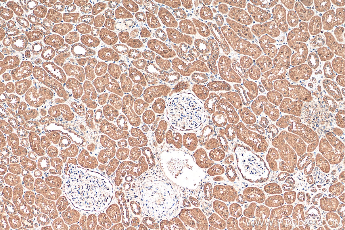 Immunohistochemistry (IHC) staining of human kidney tissue using EEFSEC Polyclonal antibody (10628-1-AP)