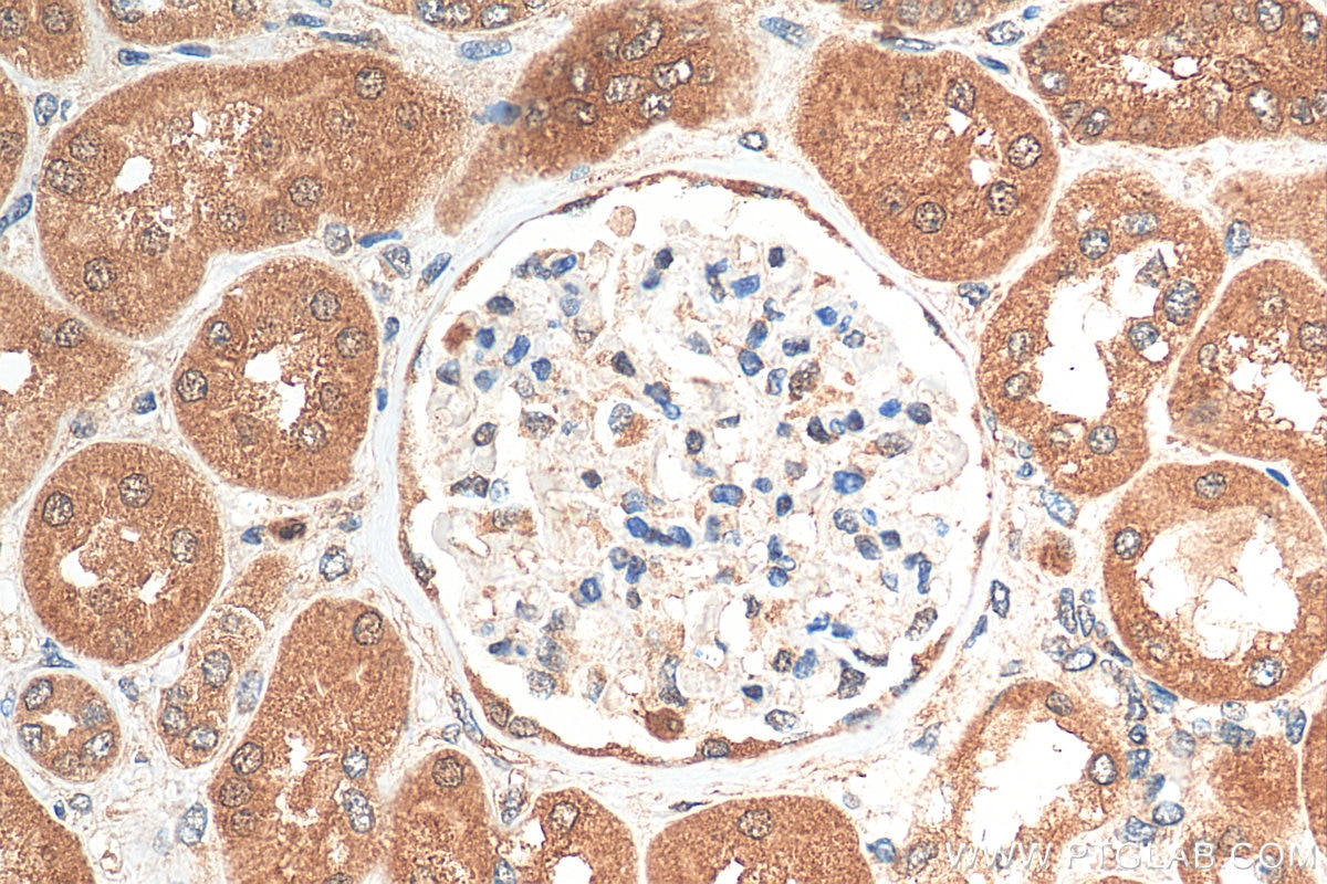 Immunohistochemistry (IHC) staining of human kidney tissue using EEFSEC Polyclonal antibody (10628-1-AP)