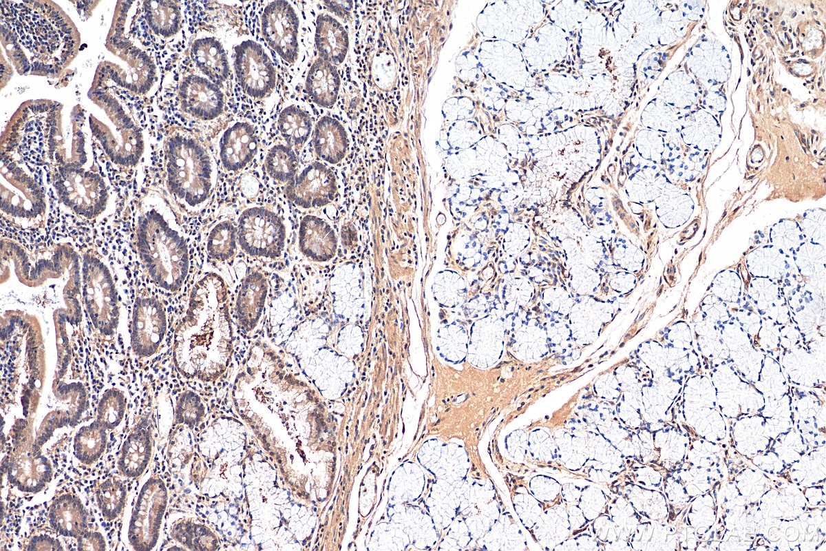 Immunohistochemistry (IHC) staining of human stomach tissue using EEFSEC Polyclonal antibody (10628-1-AP)