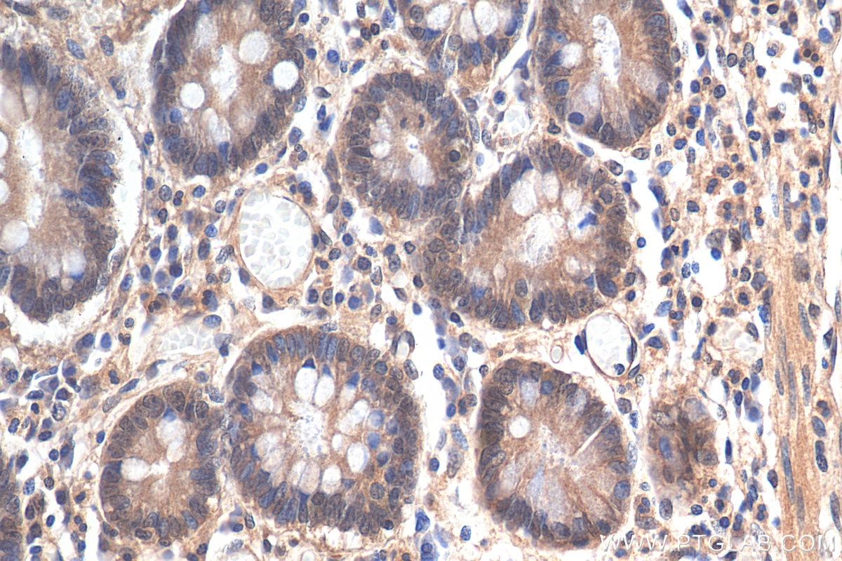 Immunohistochemistry (IHC) staining of human stomach tissue using EEFSEC Polyclonal antibody (10628-1-AP)