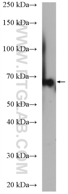 Western Blot (WB) analysis of A431 cells using EEFSEC Polyclonal antibody (10628-1-AP)