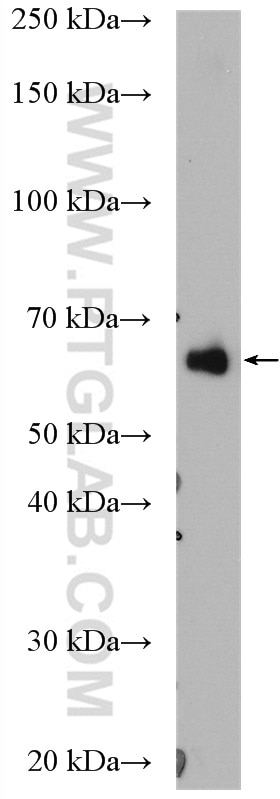 Western Blot (WB) analysis of HEK-293 cells using EEFSEC Polyclonal antibody (10628-1-AP)