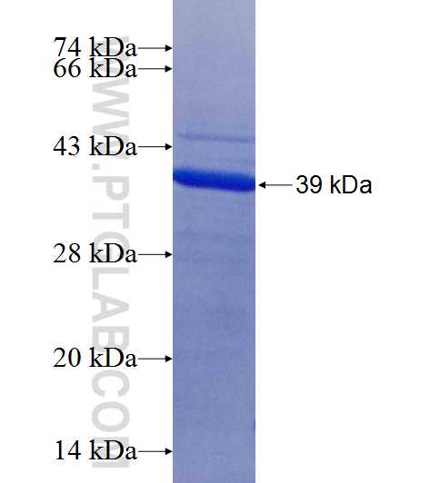 EEFSEC fusion protein Ag25761 SDS-PAGE