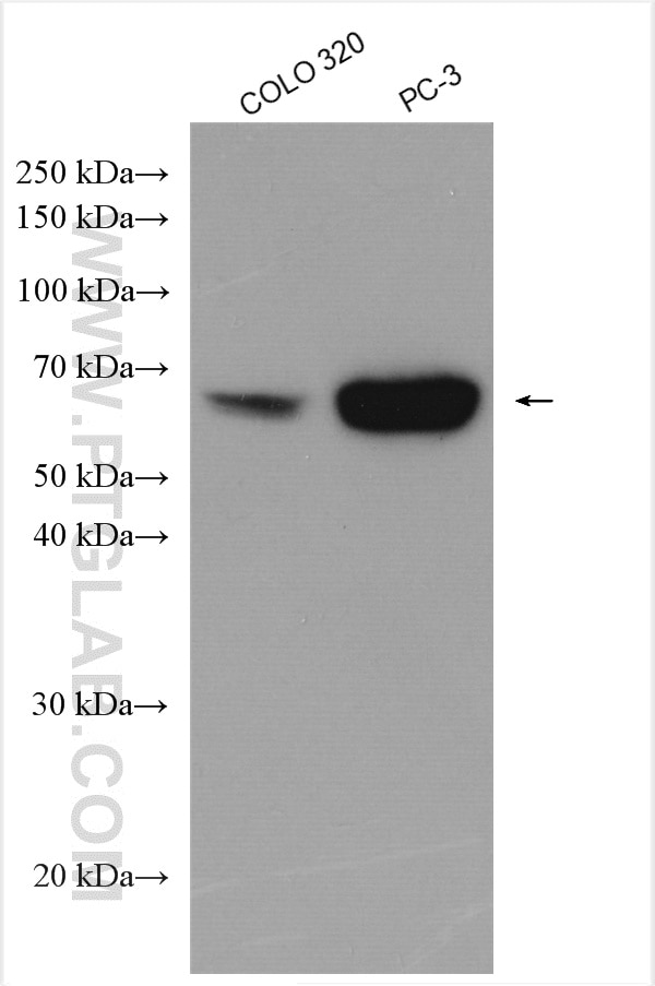 Western Blot (WB) analysis of various lysates using EEPD1 Polyclonal antibody (24310-1-AP)
