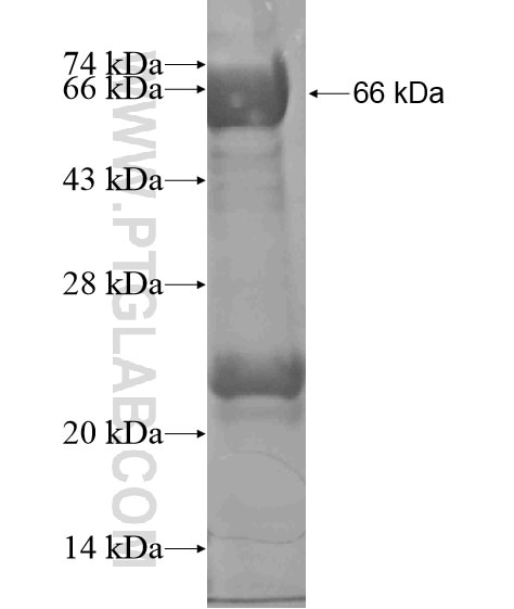 EEPD1 fusion protein Ag19423 SDS-PAGE