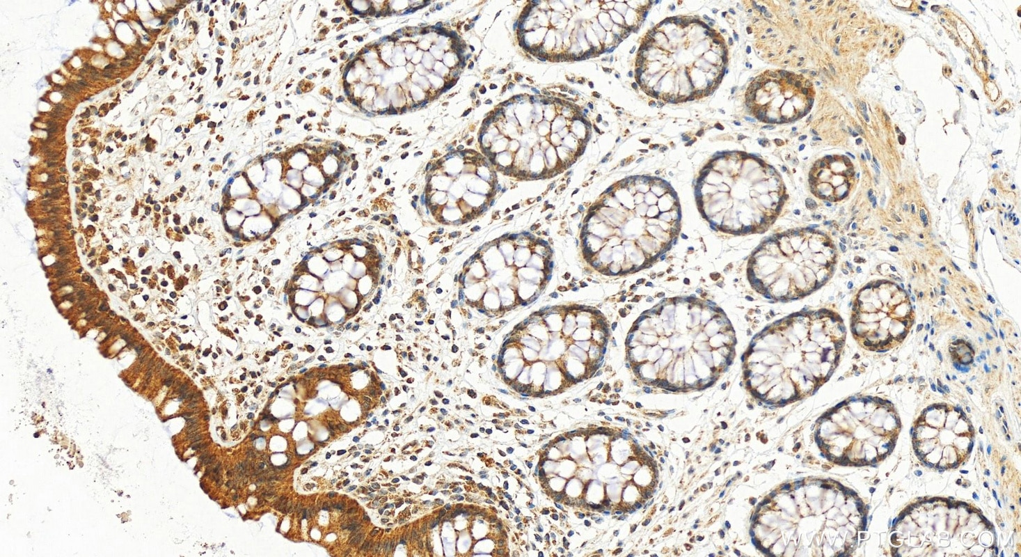 Immunohistochemistry (IHC) staining of human colon tissue using EFCAB1 Polyclonal antibody (17276-1-AP)