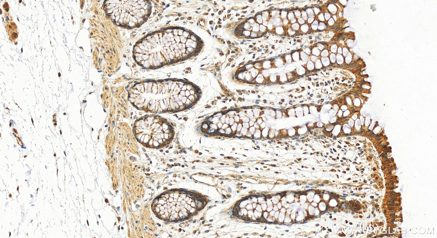 Immunohistochemistry (IHC) staining of human colon tissue using EFCAB1 Polyclonal antibody (17276-1-AP)