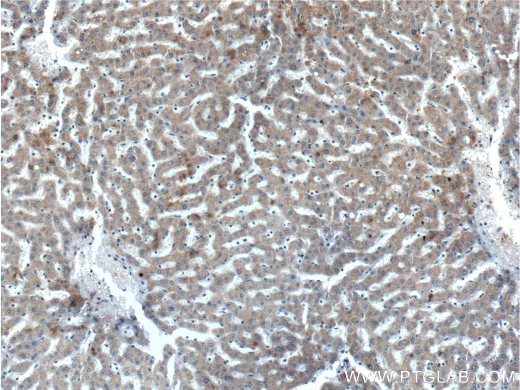 Immunohistochemistry (IHC) staining of human liver tissue using EFCAB1 Polyclonal antibody (17276-1-AP)