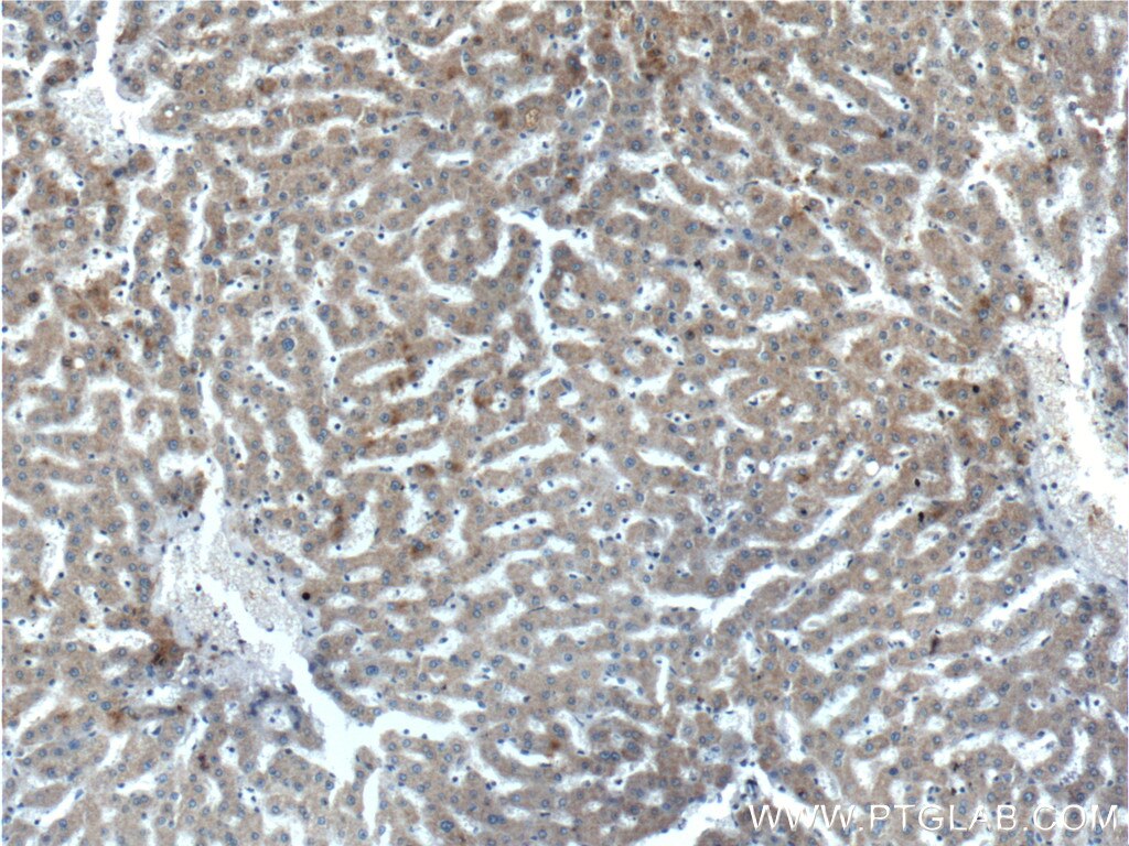 Immunohistochemistry (IHC) staining of human liver tissue using EFCAB1 Polyclonal antibody (17276-1-AP)