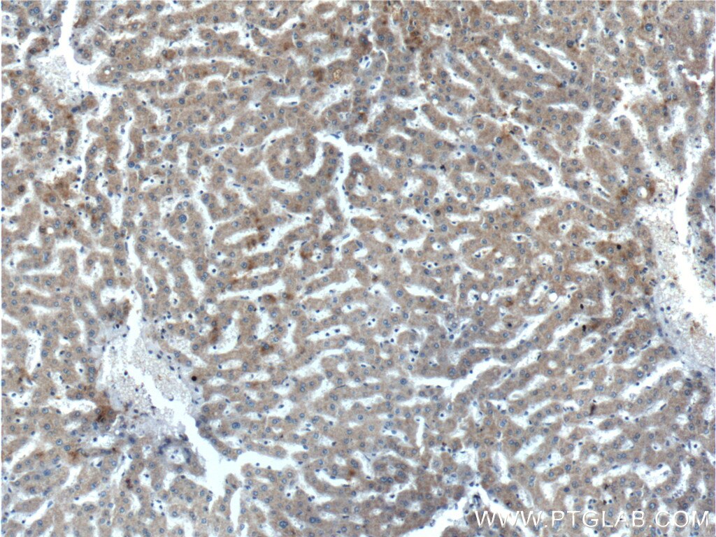 Immunohistochemistry (IHC) staining of human liver tissue using EFCAB1 Polyclonal antibody (17276-1-AP)