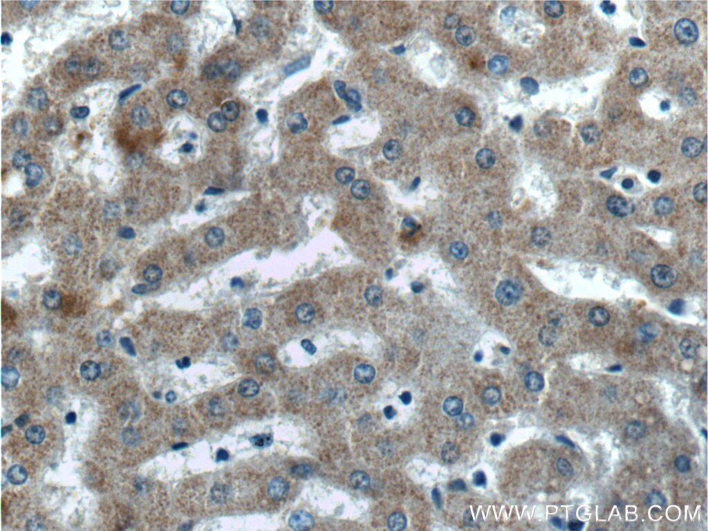 Immunohistochemistry (IHC) staining of human liver tissue using EFCAB1 Polyclonal antibody (17276-1-AP)