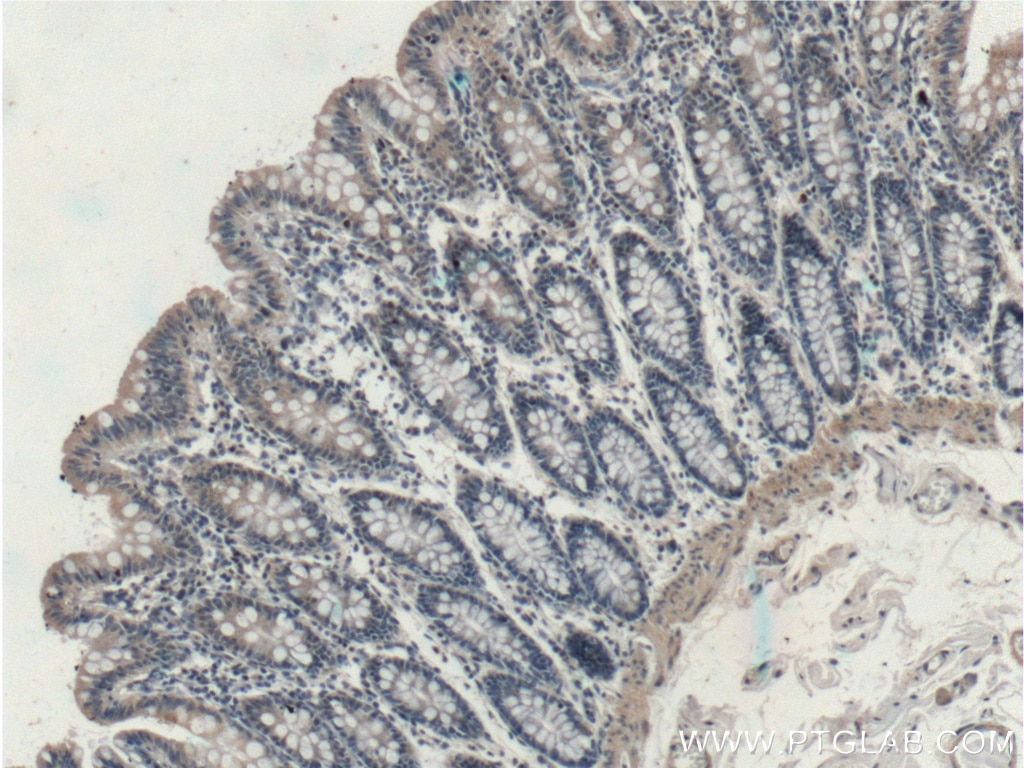 Immunohistochemistry (IHC) staining of human colon tissue using EFCAB1 Polyclonal antibody (17276-1-AP)