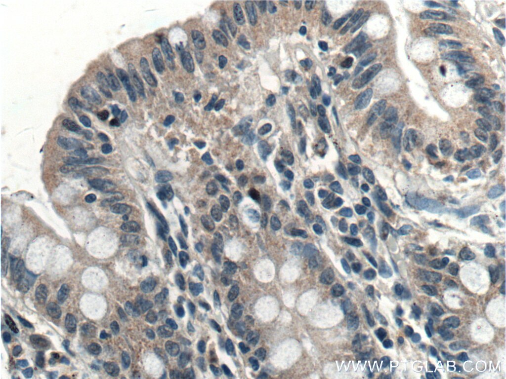 Immunohistochemistry (IHC) staining of human colon tissue using EFCAB1 Polyclonal antibody (17276-1-AP)