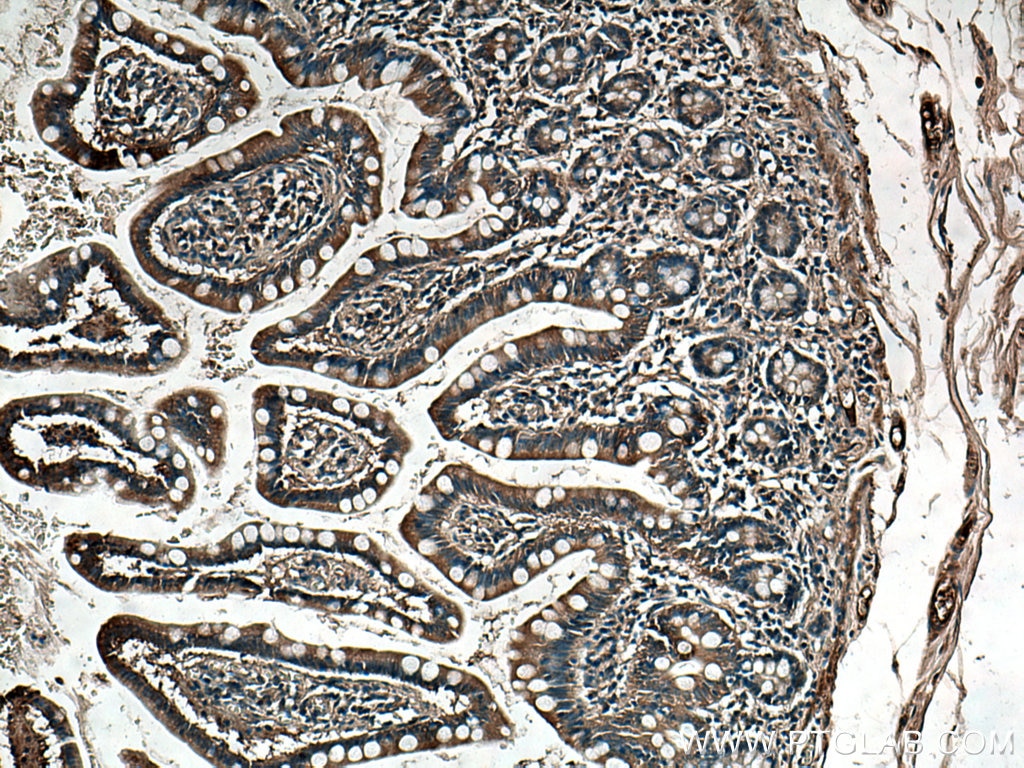 IHC staining of human small intestine using 25156-1-AP