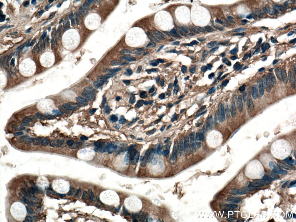 Immunohistochemistry (IHC) staining of human small intestine tissue using EFCAB2 Polyclonal antibody (25156-1-AP)