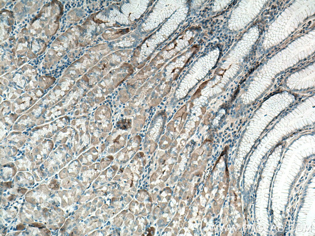 Immunohistochemistry (IHC) staining of human stomach tissue using EFCAB2 Polyclonal antibody (25156-1-AP)