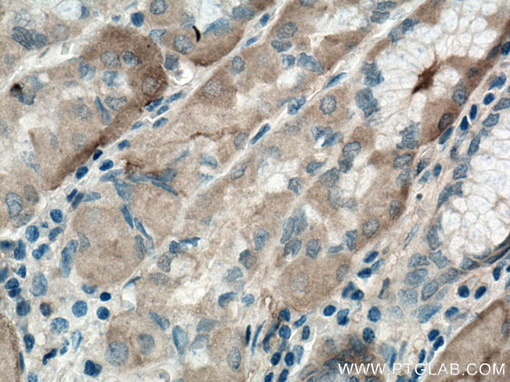 Immunohistochemistry (IHC) staining of human stomach tissue using EFCAB2 Polyclonal antibody (25156-1-AP)