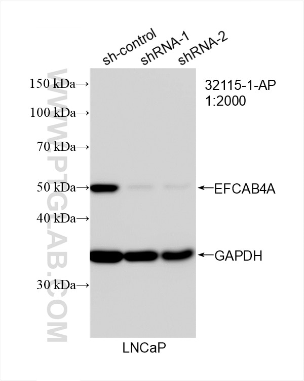Western Blot (WB) analysis of LNCaP cells using EFCAB4A Polyclonal antibody (32115-1-AP)