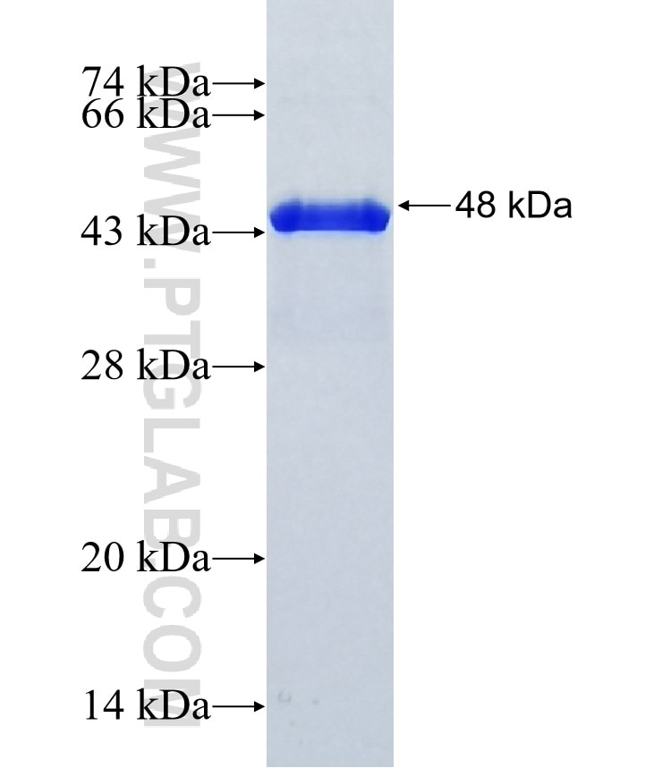 EFCAB4A fusion protein Ag37031 SDS-PAGE EFCAB4A fusion protein Ag37031 SDS-PAGE