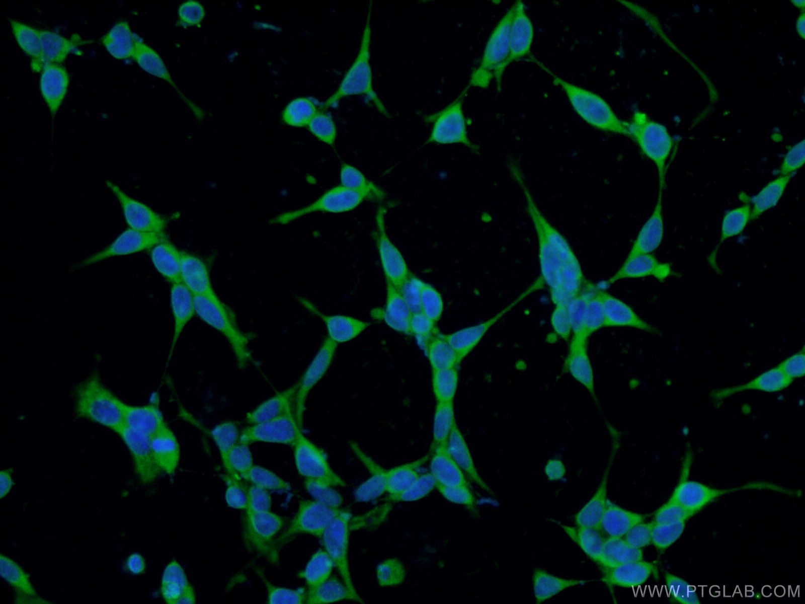 Immunofluorescence (IF) / fluorescent staining of HEK-293 cells using CRACR2A Polyclonal antibody (15206-1-AP)