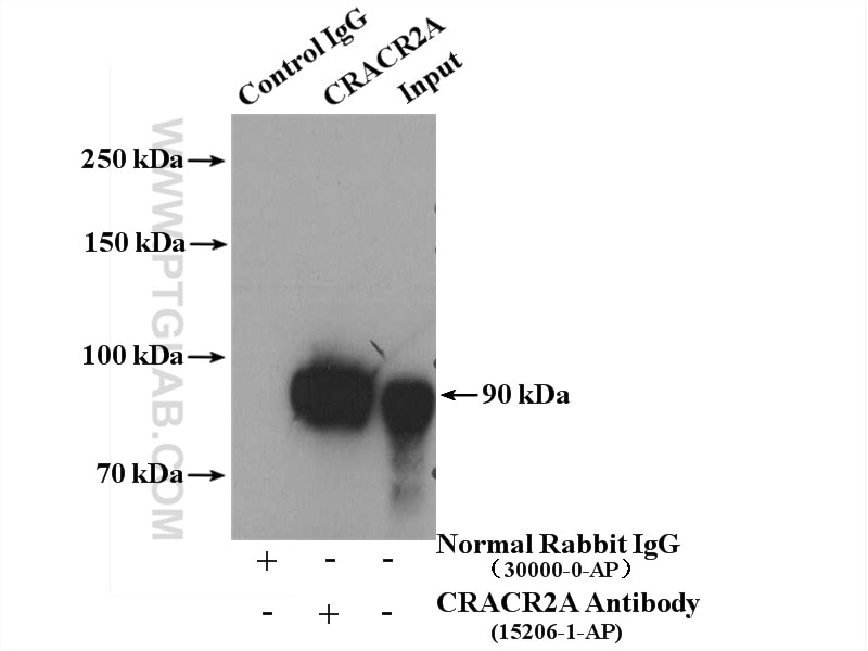 Immunoprecipitation (IP) experiment of Jurkat cells using CRACR2A Polyclonal antibody (15206-1-AP)