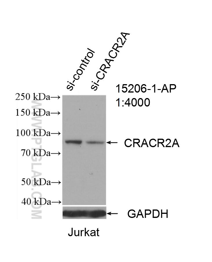 Western Blot (WB) analysis of Jurkat cells using CRACR2A Polyclonal antibody (15206-1-AP)